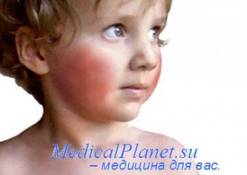 Местные проявления болезни. Общие влияния болезни на организм