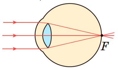 Нормальний зір