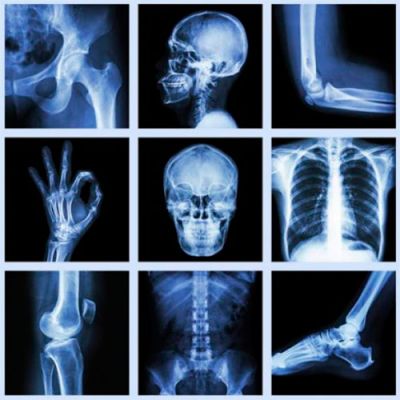 Рентгенівське випромінювання